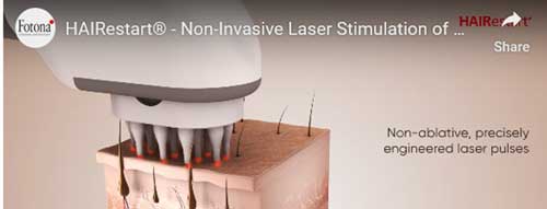 HAIRestart Non-Invasive Laser Stimulation