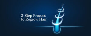 Regrow Hair