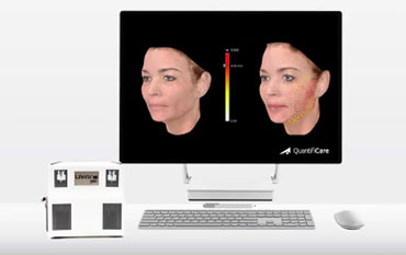 Quantificare LifeViz Mini Pro 3D