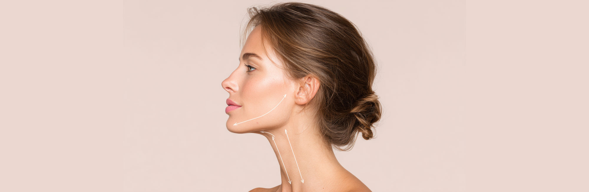 Fotona EndoTight Full Facial Contouring