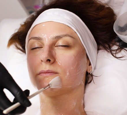 Chemical Peel Exfoliation