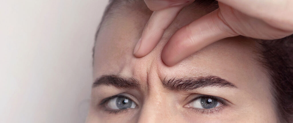 Glabellar wrinkles over the last 100 years.